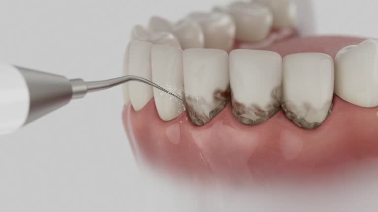 Trusted Dental Implants service in Richardson, TX - Dentist Open Now